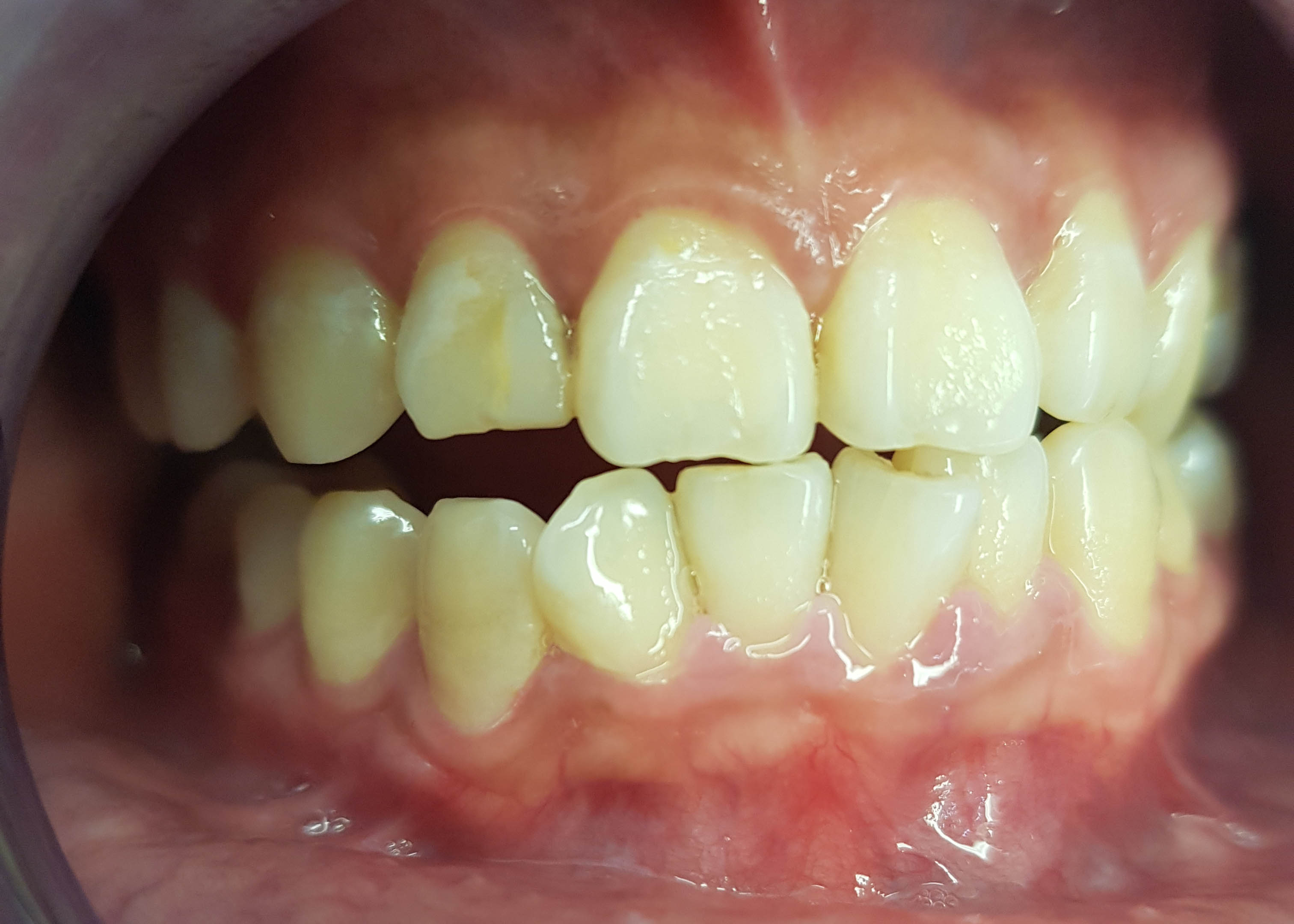 Esthetische Tandheelkunde