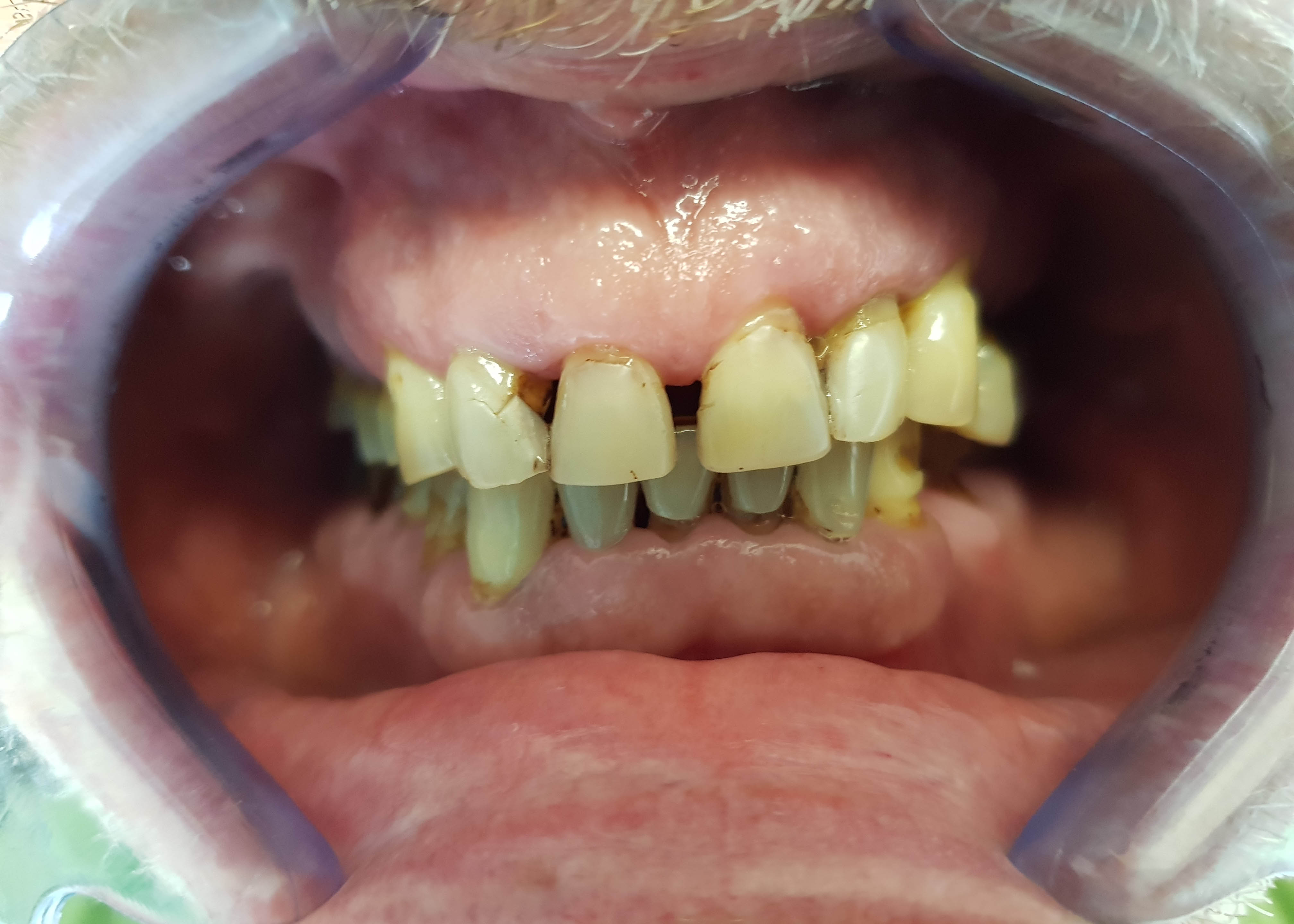 Tandarts-MCP-Metamophose