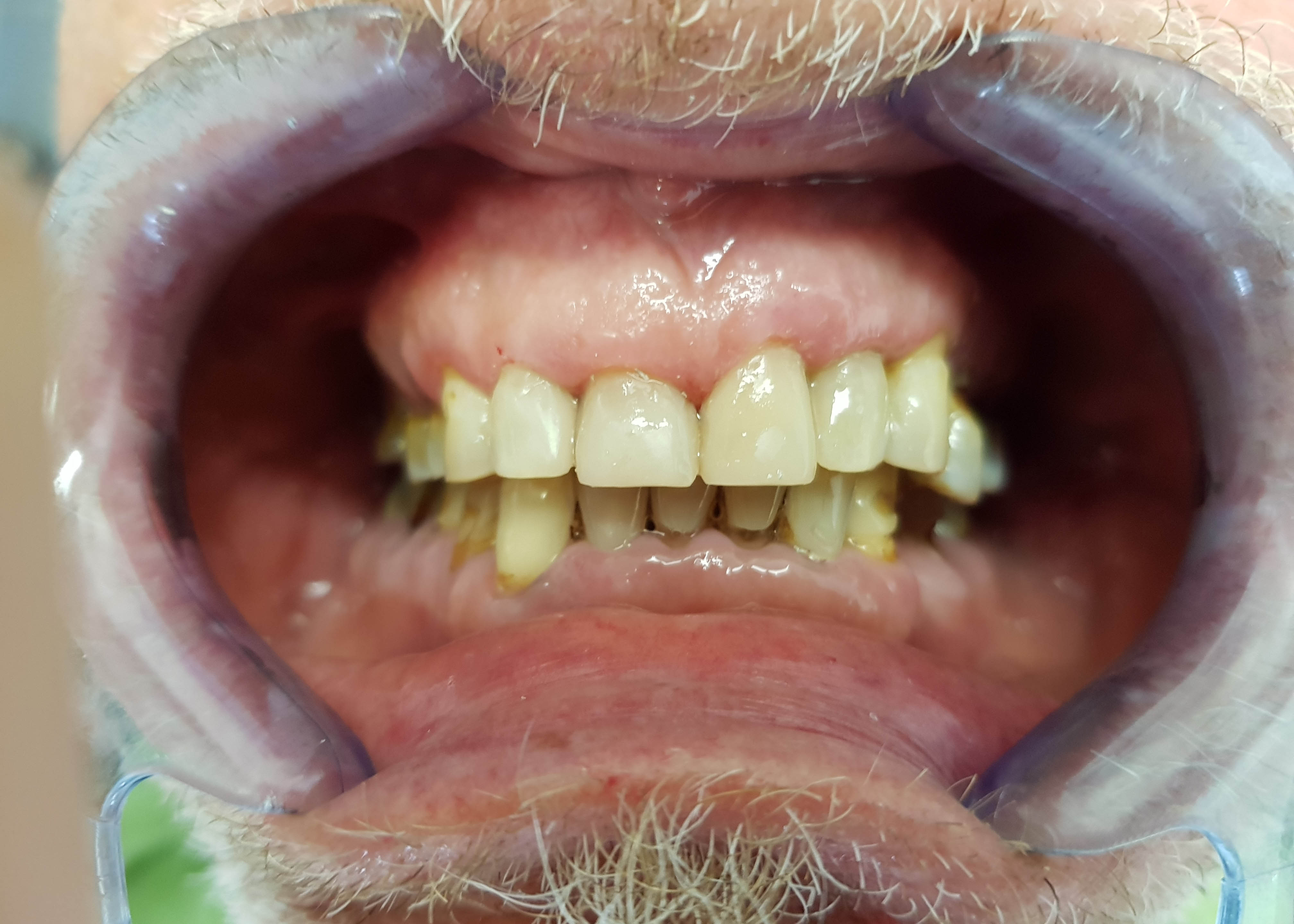 Tandarts-MCP-Metamophose